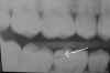 fingernail.jpg (14172 bytes)