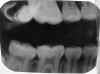 fingerprint.jpg (40957 bytes)