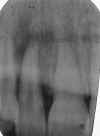 foggedfilm.jpg (39961 bytes)