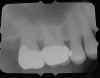 maxforeshort.jpg (16876 bytes)