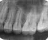 reversed.jpg (47901 bytes)