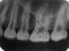 scratchedfilm.jpg (37625 bytes)