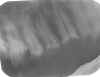 slopeplane.jpg (31244 bytes)
